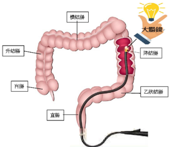 大腸鏡檢查直腸至盲腸示意圖