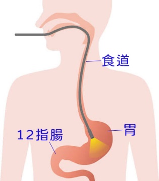 胃鏡檢查食道、胃及十二指腸示意圖